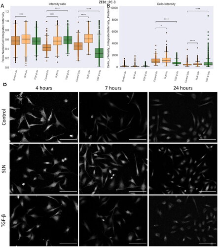 Figure 9. ZEB1 protein in PC3 cells after 24 h of treatment. PC-3 cells were treated with SLN:pET28A and TGF-β (10 ng/mL) for 4 h. After 4 h, the culture medium was replaced by RPMI without FBS. The cells were fixed at 4, 7, and 24 h after transfection and prepared for immunofluorescence for ZEB1 and SNAIL. The images were acquired in Cytation 5 cell Imaging Multi-Mode Reader (BioTek Instruments, Inc., Winooski, VT, USA) using a 10× objective. On average, 5×104 cells were counted in each treatment. (A) Intensity ratio between the integrated intensity of the nuclei/integrated intensity of the cells for ZEB1; (B) Integrated intensity of ZEB1 within the cells, and (C) Representative images of the PC-3 cells for ZEB1 marker. Each value represents the median (central line in the boxplot) ± the lower quartile, the upper quartile, and outliers represented by points from three independent experiments (n = 1) Z-test (comparison of means with all other means) was performed using statannotations and statmodels package: ****For p< =1.00e-04. Scale bar 50 μm.