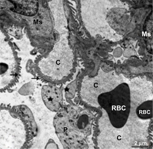 Figure 6 Transmission electron micrograph of kidney glomerular tissue from the control group showing a capillary tuft containing red blood cells, podocytes with primary (star) and secondary (arrows) processes, and mesangial cells. Scale bar 2 μm.Abbreviations: C, capillary tuft; Ms, mesangial cells; P, podocytes; RBC, red blood cells.
