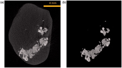 Figure 4. (a) A typical micro-CT image before applying the threshold, and (b) a micro-CT image showing only voxels containing nanoparticles to determine the nanoparticle distribution volume.