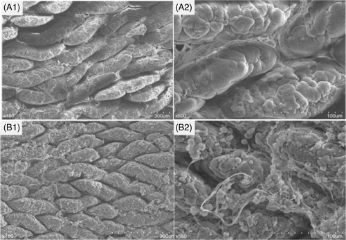 Figure 2. Ultrastructure examination of rat jejunal epithelium on day 3; top row, control group; lower row, heat-stress group (A1, B1, 1500 × magnification; A2, B2, 5000 × magnification). Abnormal microstructure was found after heat stress. A large amount of inflamed fibrous substances flowed out, tight junctions between epithelial cells became obscure, and intercellular spaces were loosened.