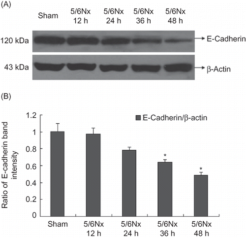 Figure 7. Expression of E-cadherin at different time points of HK-2 cells. (A) Western blot analysis of E-cadherin in cultured cells at different time points. (B) E-Cadherin protein levels. Data were expressed versus β-actin and compared with ANOVA.*Denotes p < 0.05 versus sham operation serum group.