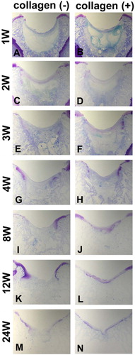 Figure 1. Effect of collagen matrix on cartilage repair. Transverse sections of collagen (-) defect (A, C, E, G, I, K, and M) and collagen (+) defect (B, D, F, H, J, L, and N). (A) and (B) show the defects at the first postoperative week. Arrows indicate the regions where there is an abundance of spindle-shaped cells. (C) and (D) show the defects at the second week. Arrowheads indicate the initial site of proteoglycan production. (E) and (F), (G) and (H), (I) and (J), (K) and (L), and (M) and (N) show those at the fourth, eighth, twelfth, and twenty-fourth week, respectively. Note the collagen(-) defect does not produce sufficient cartilage matrix, whereas the collagen(+) defect succeeds in resurfacing of the articular cartilage (toluidine blue).