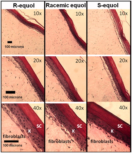 Figure 1. Validation of EFT skin culture integrity. Representative EFT histological sections across the R-equol, racemic equol, and S-equol treatments for the gene array experiments are displayed at 10×, 20×, and 40× magnification. Marker bars are shown in the bottom left-hand corner in the frames. The skin sections were stained with hematoxylin/eosin and all treatment slides displayed intact and healthy epidermal layers (SC = stratum corneum and K = keratinocytes), dermal (fibroblasts) components, and epidermal/dermal borders.