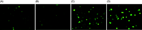 Figure 8. Calcein fluorescence after hyperthermia treatment. (A) Dx5 cells without any treatment; (B) Dx5 cells treated by 1 h 43°C incubator hyperthermia; (C) Dx5 cells treated by 5 µM ICG + 3 min laser; (D) Dx5 treated with verapamil. All the images were taken under 20× magnification and the exposure time was 1000 ms. The scale bar represents 24 µm.