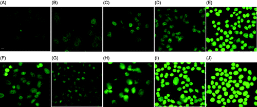 Figure 4. DOX fluorescence in MES-SA cells treated by only DOX (A and F), DOX + 1 h 43°C incubation (B and G), DOX + 30 min 50°C incubation (C and H), DOX + 3 min laser/5 µM ICG (D and I), and DOX + 3 min laser/10 µM ICG incubation (E and J). Images were taken either 1 h after (A, B, C, D and E), or 24 h after the treatment (F, G, H, I and J). The scale bar represents 8 µm.