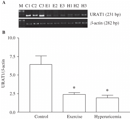 FIGURE 2. Effect of heavy muscle activity on the mRNA levels of URAT1 in renal cortex from Wistar rats. Total RNA was generated from kidney cortex. RT-PCR against URAT1 and β-actin was performed as described in Materials and Methods. (A) Typical pattern of RT-PCR products. RT-PCR leads to products of the predicted lengths for URAT1 (231 bp), and β-actin (282 bp). (B) Effect of heavy muscle activity on the mRNA levels of URAT1. Amount of URAT1 mRNA signal normalized to the respective signal from β-actin. Data are mean ± SEM of measurements in five independent experiments each group. *p < 0.01 Statistical differences from control animals.