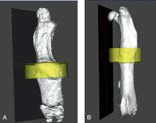 Figure 2. Three-dimensional reconstruction at 12 weeks (with yellow region corresponding to ROI1). A. Low-rigidity group. B- High-rigidity group.