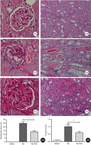 Figure 3. The severity of the chronic kidney disease from renal histology was attenuated by Hibiscus sabdariffa Linn. (HS). The renal histology results are representative of four to eight rats per group. Results from the Periodic Acid-Shiff (PAS) staining of the glomerulus (left panel) and tubulointerstitium (right panel) for the sham control group (sham control rats: A, B), Nx group (placebo-treated 5/6 Nx rats: C, D), and Nx+HS group (HS-treated 5/6 Nx rats: E, F). Magnification of the glomeruli was done at 400X and the interstitial area at 200X. The analysis of the glomerular injury (G) and the tubulointerstitial injury (H) are shown for sham control rats (sham: n = 4), placebo-treated 5/6 Nx rats (Nx: n = 8), and HS-treated 5/6 Nx rats (Nx+HS: n = 8). Note: * indicates p < 0.05.