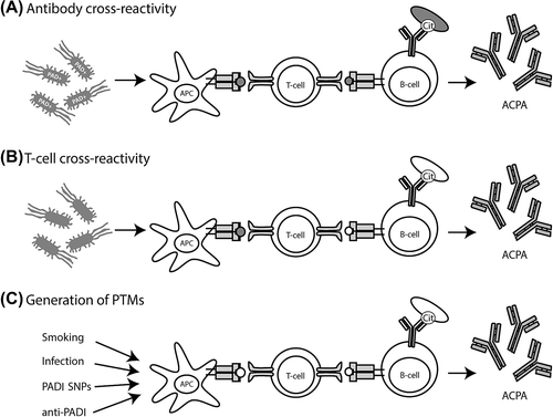 Figure 3. Models explaining loss of tolerance in RA. A: Infection and subsequent citrullination of microbial proteins results in the activation of microbe-directed T-cells. These microbe-directed T-cells can provide help to B-cells specific for a citrullinated microbial protein resulting in the production of ACPA cross-reactive to citrullinated self-proteins. Microbial proteins could become citrullinated by human or by bacterial PADI enzymes. B: Infection with microbes that have proteins with a high degree of similarities with self-protein could activate self-reactive T-cells. These self-reactive T-cells can subsequently provide help to B-cells specific for citrullinated self-proteins resulting in the production of ACPA. C: The amount of citrullinated proteins could be enhanced by smoking, infection with PADI-containing bacteria, polymorphisms within the PADI locus, or by anti-PADI antibodies. Enhanced citrullination of self-proteins occurs by several causes. Presentation of citrullinated neo-antigens by HLA-SE molecules activates citrulline-directed CD4 + T-cells that can help ACPA-producing B-cells. In each of the models antigens indicated in white are self-derived and antigens indicated in grey are pathogen-derived.