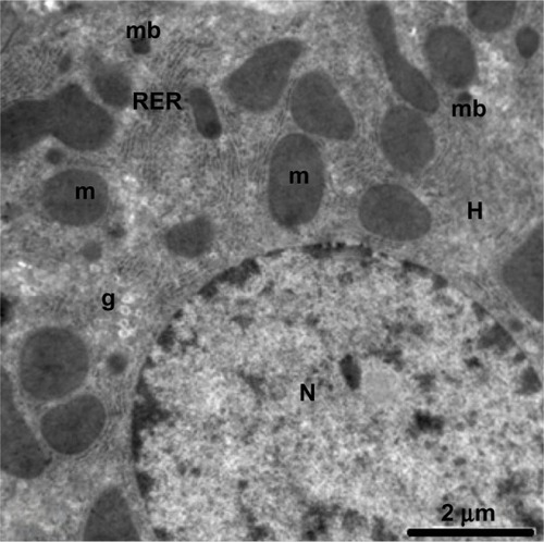 Figure 13 Transmission electron micrograph of a hepatic cell from the control group showing the normal ultrastructure of the hepatic cell, nucleus, mitochondria, rough endoplasmic reticulum, microbodies, and glycogen granules. Scale bar 2 μm.Abbreviations: g, glycogen granules; H, hepatic cell; m, mitochondria; mb, microbodies; N, nucleus; RER, rough endoplasmic reticulum.