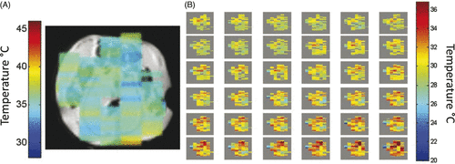 Figure 4. In vivo demonstration of the HOT sequence Citation[32]. (A) shows the overlay of a 2-minute HOT temperature maps on an anatomical image of a mouse. The uniformity of the voxels is as expected for the natural temperature distribution of a mouse. (B) is of a mouse with a tube of water next to it. The water is heated over the course of the experiment and the heating is observed in the temperature images. TE = 40 ms, TR = 2 s, τ = 10.66 ms, t1 = 3–13 ms, indirect spectral width = 4000 Hz, correlation distance = 0.0945 mm, voxel size = 0.25 cm3.