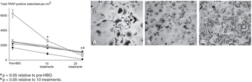 Figure 1. Daily HBO therapy suppresses RANKL-induced osteoclast formation in a treatment number-dependent manner. Human PBMCs were incubated in the presence of RANKL (30 ng/mL) and M-CSF (50 ng/mL), stained for TRAP, and the total number of TRAP-positive osteoclasts quantified. Representative images of RANKL-treated TRAP-stained cultures from pre-HBO group (panel A), 10 HBO exposures (B), and 25 HBO exposures (C) (magnification ×40). Arrows show examples of multinucleated osteoclasts and arrowheads show examples of mononuclear osteoclasts. Data are expressed as mean ± SEM (n = 6).