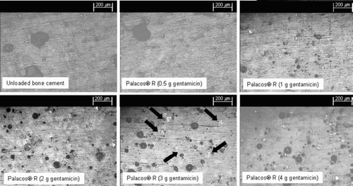 Figure 5. Micrographs of unloaded and gentamicin-loaded bone cements in which antibiotic agglomerates can be identified as white clusters (arrows show examples). The micrographs of the unloaded Palacos R and Palacos R with 0.5 g gentamicin show no evidence of antibiotic agglomerations. The bone cements containing 1 g or 2 g of gentamicin show a small number of agglomerations within the cement microstructure, and a much larger number is present in the cements containing 3 g or 4 g of gentamicin.