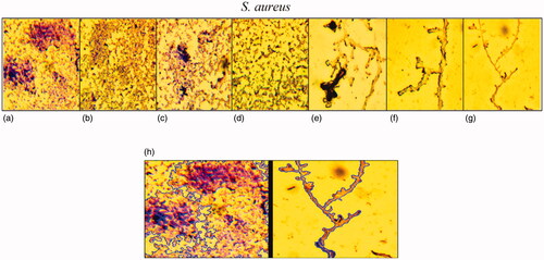 Figure 14. Light microscopic images (at a magnification of 40×) of antibiofilm activity of Fe3O4 NPs in various concentrations 0 (a), 3.12 (b), 6.25 (c), 12.5 (d), 25 (e), 50 (f), 100 μg/mL (g) and comparison of biofilm area between control and NPs concentration by 100 μg/mL.