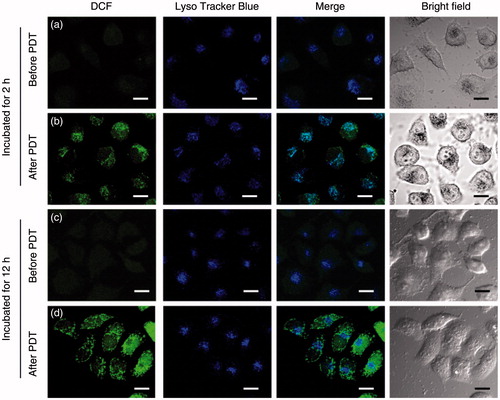 Figure 8. Subcellular localization of ROS generated during capsule-mediated PDT. HeLa cells were incubated with MPN@HMMEs (30 μg mL−1) for 2 (a, b) or 12 (c, d) h, followed by DCFH-DA and LysoTracker Blue staining for 15 min with irradiation dose of 20 J cm−2. Scale bars are 30 μm.
