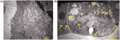 Figure 3. The images confirm the entry of nanoparticles into the cell: (A) control image, (B) image with nanoparticles.