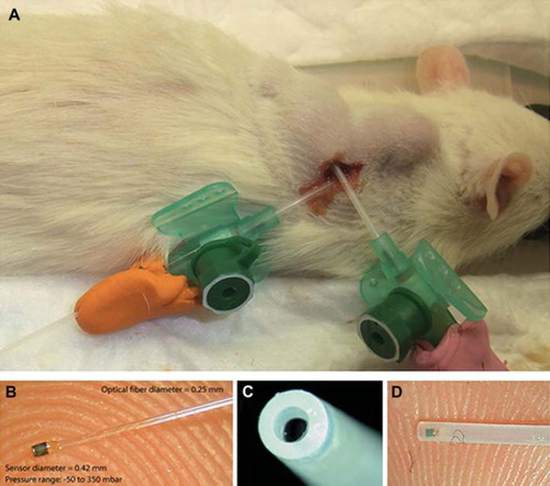 Figure 2. IFP measurement setup. A. An anaesthetized Fisher rat with two bulging ellipsoid subcutaneous MAT B III tumors. A FOPT is inserted in each tumor, guided by a Venflon™ tube. Plastic clay applied to prevent leakage. B. A FOPT with a sensor in its distal (left) end is shown resting on a finger tip. Note the small dimensions. C. A 0.5 mm space, filled with fluid in situ, is located between the orifice of the PTFE tube and the sensor (dark), enclosed by a protective PTFE tube. D. A side view of a FOPT showing to the left the sensor as a dark spot, inserted in a protecting PTFE tube. This construction prevents direct load on the sensor by the tissue, which may cause faulty recordings.