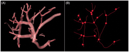 Figure 3. (A) Vessel centre lines recognition in the anterior right liver lobe. (B) Vessel centrelines extraction and bifurcations automatically marked as small spheres.