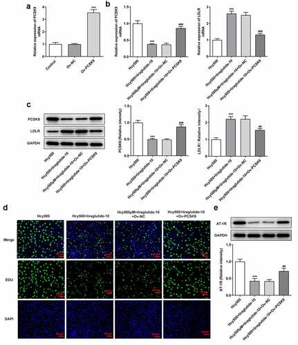 Figure 4. Liraglutide alleviates the proliferation of Hcy-induced VSMCs by suppressing PCSK9/LDLR. (a) The expression of PCSK9 after creating the overexpression plasmid of PCSK9. ***P < 0.001 vs. Control group. (b-c) The mRNA and protein expression of PCSK9 and LDLR in Hcy-induced VSMCs treated with liraglutide. ***P < 0.001 vs. Hcy 500 group; ##P < 0.01 and ###P < 0.001 vs. Hcy500+ liraglutide-10 group. (d) The apoptosis of Hcy-induced VSMCs co-treated with liraglutide and Ov-PCSK9 (the plasmids overexpressing PCSK9). (e) The expression of AT-1 R in Hcy-induced VSMCs co-treated with liraglutide and Ov-PCSK9. ***P < 0.001 vs. Hcy500 group; ##P < 0.01 vs. Hcy500+ liraglutide-10 group