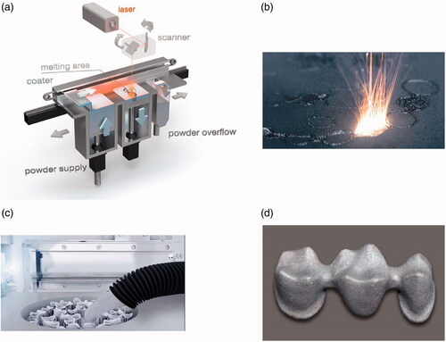 Figure 1. Images of (a) operating principle of the SLS process (Image courtesy of Concept Laser GmbH). (b) Laser beam melting of metal powder in powder bed fusion), (c) cleaning remaining powder, (d) 3-unit framework of fixed dental prosthesis. Images with courtesy of EOS GmbH, Munich, Germany.