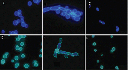 Figure 1.  Visualisation of the effect of maleimides on morphology of Candida albicans yeast cells. (A–C) Cells stained for chitin with Calcofluor White. (A) Control, (B) cells treated with 1, 5 µg ml−1; (C) cells treated with 7, 5 µg ml−1. (D–F) Cells stained for glucan with aniline blue. (D) Control, (E) cells treated with 1, 5 µg ml−1; (F) cells treated with 7, 5 µg ml−1.
