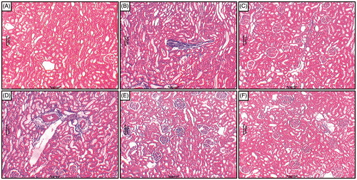 Figure 3. Effect of naringin on sodium arsenite-induced alteration in kidney histology of rats. Photomicrograph of sections of kidney from normal group (A); Arsenic Control group (B); Coenzyme Q10 (10 mg/kg, p.o.) treated group (C); Naringin (20 mg/kg, p.o.) treated group (D); Naringin (40 mg/kg, p.o.) treated group (E) and Naringin (80 mg/kg, p.o.) treated group (F). MT staining at 100×.