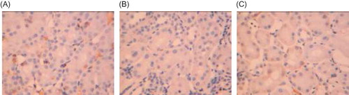 Figure 8. CD34 expression in rat renal tissue (×250). (A) CD34 was largely expressed in the renal tubular interstitium in the control group. (B) A decreased CD34 expression was found in the renal interstitium in the model group. (C) CD34 expression in the renal tissue was significantly increased in Cozaar group as compared with the model group.