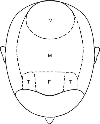 Figure 1. Areas of the scalp.