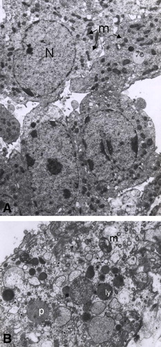 Figure 5 Leydig cell alteration in testis from rats that received Hg by oral route. (A) Microphotography of a tissue section from a control rat that only received deionized water. N: nucleus, m: mitochondria (arrows) (2950X). (B) Section from a rat treated with 0.05 μg/ml of Hg for 3 months showing peroxisomes (p), secondary lysosomes (ly) damaged mitochondria (m) and dilated endoplasmic reticulum (arrows) (6600X).