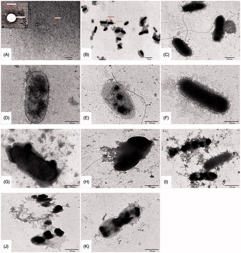 Figure 2. Characteristic TEM images of P. aeruginosa treated with various liposomal formulations at 4× MIC concentrations. (A) Bare liposomes, (B) MDRPa strain PS103, 4 h incubation with (C) L-CPM, (D) L-IPM, (E) L-CAZ, (F) L-Pch-CPM, (G) L-Pch-IPM, (H) L-Pch-CAZ and 6 h incubation with (I) L-Pch-CPM, (J) L-Pch-IPM and (K) L-Pch-CAZ.