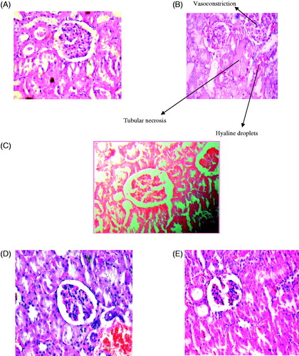 Figure 5. Histopathological evidence of cisplatin-induced proximal tubular toxicity. Representative histopathology stained sections from kidney of plate (A) vehicle-treated (magnification 20×), (B) cisplatin-treated rats (5 mg/kg, six days) (magnification 20×), (C) extract control Ficus religiosa treated with 200 mg/kg rats (magnification 20×), (D) protective Ficus religiosa treated with 200 mg/kg rats (magnification 20×), and (E) curative F. religiosa treated with 200 mg/kg rats (magnification 20×).