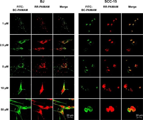 Figure 5 Intracellular colocalization of RR-PAMAM (red) and FITC-BC-PAMAM (green) in BJ and SCC-15 cells after 24 hours incubation with dendrimers at various concentrations (1–50 µM).Notes: Colocalization is shown as a yellow signal. Cell imaging was performed on a Carl Zeiss Axio Observer Z1 LSM 710 inverted confocal microscope equipped with a 63× oil immersion objective.Abbreviations: RR-PAMAM, Rhodamine Red™-X-labeled PAMAM G3; FITC-BC-PAMAM, fluorescein isothiocyanate-labeled biotin–polyamidoamine bioconjugate.