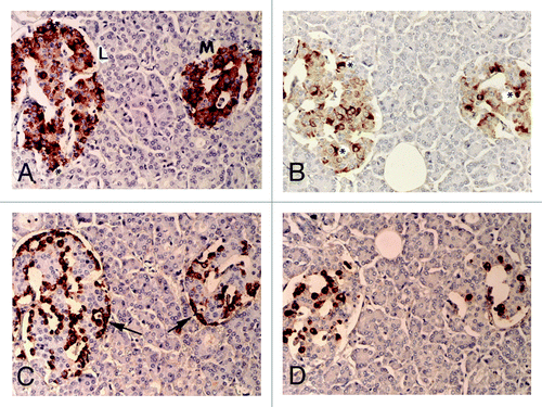 Figure 1. Control islets. β cells were the most abundant major islet cells (about 60% of total islet cells) with plump and polygonal cytoplasm of variable staining intensity, from moderate to strong staining, followed by α-cells (arrow, about 30%) with strongly stained, round smaller cytoplasm. δ cells accounted for about 15% of islet cells, containing plump or small cytoplasm. β cells and IAPP-positive cells were mostly located in the middle of islets and so were δ-cells whereas strongly immunostained α-cells (arrow) were located at the outer margin of islets and islet lobules. There were globular to sickle-shaped strongly immunostained cytoplasms for insulin and IAPP, which appeared to be dying β-cells (*). L, Large islet; M, Medium-sized islet; Original magnification X 400; (A) Insulin; (B) IAPP; (C) Glucagon; (D) SRIF immunostained.