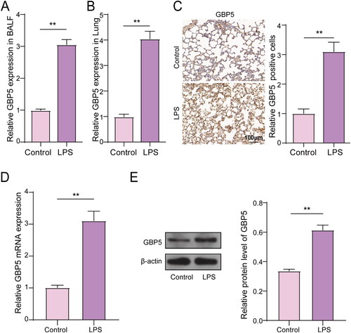Figure 1. GBP5 Expression was altered in mouse ARDS models.(A) Bar graphs showing population data of GBP5 mRNA levels in LPS and control groups from lung tissue of ARDS mice model (n = 5). (B) Same as (A), but in BALF. (C) Example images of IHC staining for GBP5 in lung tissue. (D) Population data of GBP5 mRNA levels in an ARDS cell model established by LPS-induced MLE-12 cell lines. (E) Same as (D), but in protein levels. Structures represent mean ± SD. The asterisk indicates p < 0.05.