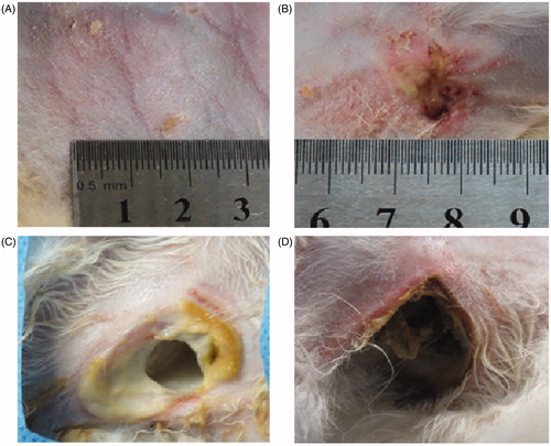 Figure 6. Visual inspection of skin injuries on post-procedure day 14. Representative photographs of gross skin injuries on post-procedure day 14. (A) Pigmentation in the perfusion group. (B) Ulceration in the pre-injection group. (C, D) Ulceration in the control group (54 × 50 mm, 300 × 300 dpi).