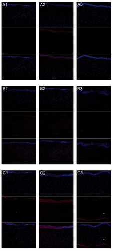 Figure 9. CLSM of DOX absorption by corneal tissues after rabbits’ eyes in vivo treated alternately with free DOX (A1–A3), (B1–B3) non-modified liposome, and (C1–C3) HA-modified liposome after (A1, B1, and C1) 0.5 h, (A2, B2, and C2) 2 h, and (A3, B3, and C3) 3 h. (Up) blue filter; (middle) red filter; (down) overlay of both (up and middle) sections.