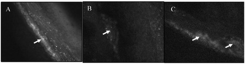 Figure 4. Intravital microscopic images of thrombus area of the mesenteric arteriole of mice following administration of FITC-labeled control liposomes (B) and FITC-labeled TS liposomes (C). (A) Represents control thrombus area in which platelets were stained with calcein-AM.