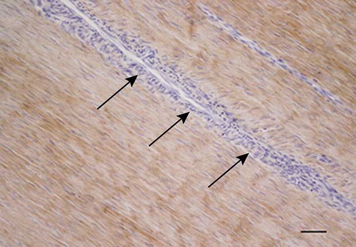 Figure 7. Microscopic longitudinal section of injured tendon (H). Immunohistochemical localization of type I collagen. Note the intense staining of the organized fibroblastic tissue, but lack of staining in the extensive endotenon (arrows). H refers to tendon ID (see Tables 1 and 2). Bar = 100 μm.