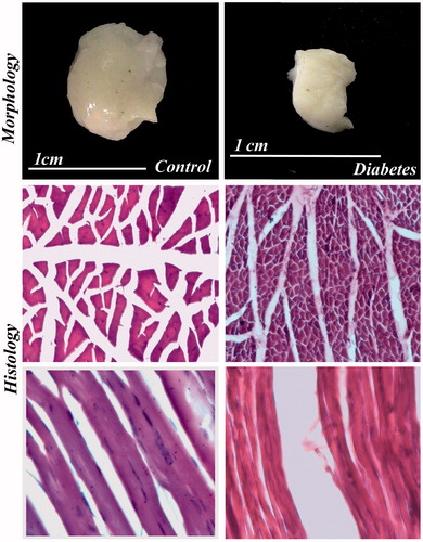 Figure 7. Morphology and histology of IC in control and diabetes. The IC muscle shows severe degenerative changes in diabetic rat. Figure showing transverse and longitudinal sections of muscle. H & E 40×.