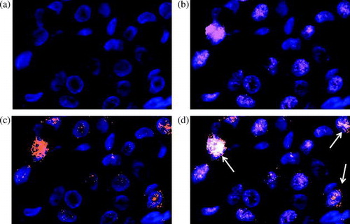 Figure 2.  Photos illustrating a. cell nuclei stained with DAPI, b. cyclin A positive cells (Cy 5), c. cyclin E positive cells (Cy 3) and d. cells co-expressing cyclins A and E (arrows).