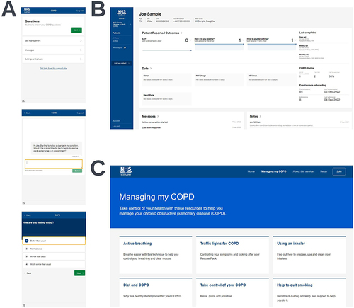 Figure 1 Screen capture views of the three components of the digital COPD support service. Views of the patient application (A), the clinician dashboard (B), and the support website (C) are shown. Synthetic data shown is for illustrative purposes only.
