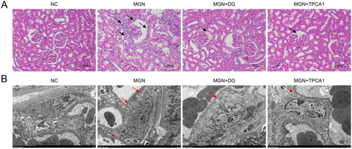 Figure 3. Effects of DG on histopathological changes in MGN rats. (A) Representative haematoxylin and eosin (H&E) staining of kidney samples (original magnification ×200; scale bar represents 100 μm). (B) Transmission electron micrographs of renal tissue (original magnification ×5000; scale bar represents 5 μm). Black arrows represent oedema and vacuolar degeneration of renal tubular epithelial cells and glomerular atrophy. Red arrows represent the presence of glomerular podocyte fusion and electron-dense deposits in the GBM and epithelia. NC: normal control; MGN: membranous glomerulonephritis; DG: diosgenin; TPCA1: [(aminocarbony)amino]-5-(4-fluorophenyl)-3-thiophenecarboxamide.