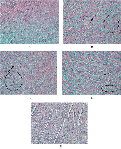 Figure 8.  Effect of hesperidin treatment on the histopathology of heart tissue of rats exposed to γ-radiation. (A) Group 1; (B) Group 2; (C) Group 3; (D) Group 4; (E) Group 5; × 200.