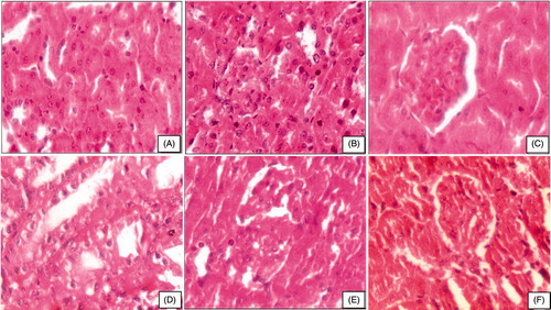 Figure 2. Photomicrograph of kidney after subchronic exposure to beryllium followed by combination therapy of moringa oleifera. (A) Control rats showing well-formed uriniferous tubules (HE, 400×). (B and C) Beryllium-treated rats showing obliteration of lumen of uriniferous tubules, exfoliation of nuclei, and contraction of glomerulus (HE, 400×). (D) Therapy with MO 150 mg showing uriniferous tubules with lumen and epithelial cell are vacuolated (HE, 400×). (E) Therapy with MO+Pip showing well-formed glomerulus and better lumen of uriniferous tubules (HE, 400×). (F) Therapy with MO+Cur showing well-formed glomeruli (HE, 400×).
