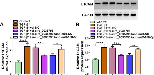 Figure 6. Circ_0035796 controlled L1CAM expression through miR-150-5p in TGF-β1-treated HFL1 cells. HFL1 cells were divided into 6 groups, including control group, TGF-β1 group, TGF-β1 + si-NC group, TGF-β1 + si-circ_0035796 group, TGF-β1 + si-circ_0035796 + anti-miR-NC group or TGF-β1 + si-circ_0035796 + anti-miR-150-5p, and L1CAM expression was assessed by qRT-PCR (A) and Western blot (B). *p < 0.05, **p < 0.01, ***p < 0.001 and ****p < 0.0001.