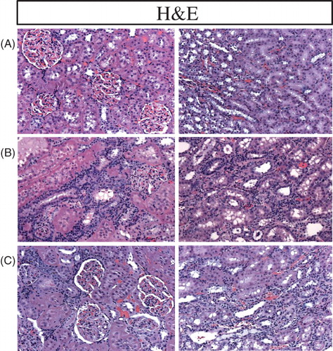 Figure 6. Representative photomicrographs of the H&E stained renal tissue (20X) in a sham-operated control (A) and a 5/6 nephrectomized rat (CKD)] treated with vehicle (B) or RTA dh404 (C). The remnant kidney in the CKD animals (B) exhibited significant glomerulosclerosis, tubulo-interstitial injury and heavy inflammatory cell infiltration. RTA dh404 treatment-reduced inflammatory cell infiltration and glomerular and tubulo-interstitial injury (C).