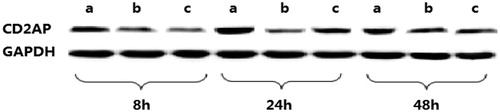 Figure 1. Western blot band of CD2AP of control group, Ang II group and Losartan group at different time points. (a): The control, (b): AngII, (c): Losartan.