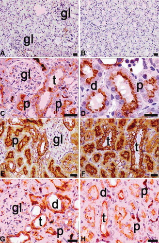 FIGURE 7. Immunohistochemical staining of NF-κB (p65) in tissue sections of control (A, B), ovariectomy (C, D), sepsis (E, F), and diabetes (G, H) groups. gl, glomerulus; d, distal tubules; p, proximal tubules; t, collecting tubules; positivity was seen in especially cytoplasmic pattern of tubular cells in ovariectomy (C, D), sepsis (E, F; the most expression of p65), and diabetes (G, H) groups; magnification bars: 30 μm.