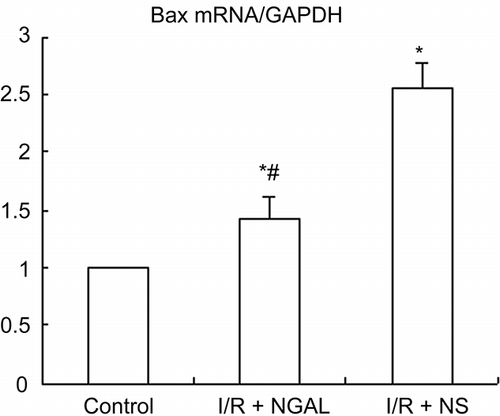 Figure 5.  The mRNA expression of Bax gene in kidney of rat. Quantification of Bax mRNA normalized to GAPDH. NGAL-treated rat reduced the level of Bax mRNA compared to the I/R + NS group. Note: *p < 0.05 versus the control group, #p < 0.05 versus I/R + NS group. Data are mean ± standard deviation (SD) for n = 6 animals per group.