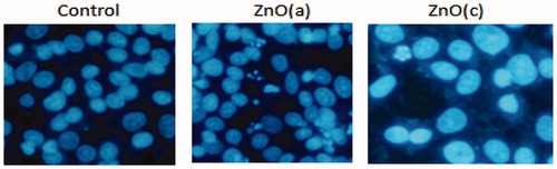 Figure 4. Detection of typical features for apoptosis nuclear condensation by Hoechst 33258 staining. MCF-7control (untreated) and treated with 100 μg/ml of ZnO (a) and ZnO (c) were stained with Hoechst 33258.